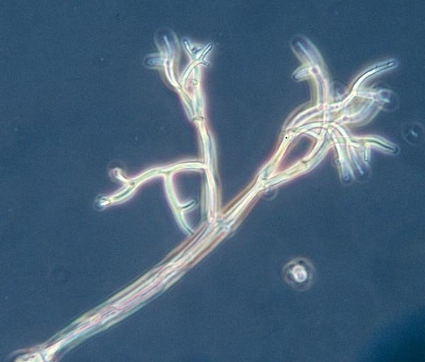 nguyen-nhan-nao-gay-ra-benh-suong-mai-o-hoa-hong