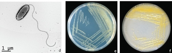 xanthomonas-campestrippv-cv-gay-benh-ri-dom-mat-cua-sau-rieng