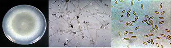 colletotrichum-gloeosporioides