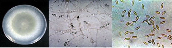 nguyen-nhan-gay-benh-than-thu-ca-phe