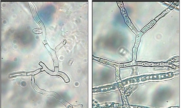 Top 3 thuốc đặc trị cháy lá trên cây sầu riêng được chuyên gia khuyên dùng 2 nguyen-nhan-sau-rieng-bi-chay-la