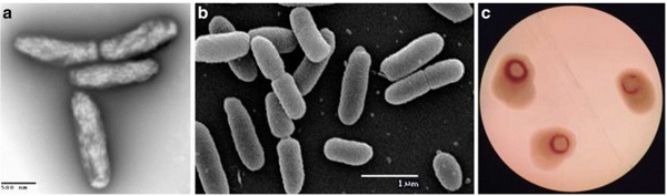 Bệnh héo xanh vi khuẩn là gì? Có thuốc trị bệnh héo xanh vi khuẩn không? 1 pseudomonas-solanacearum-smith