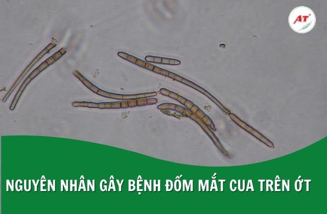 Nguyên nhân gây bệnh đốm mắt cua trên ớt là nấm Cercospora capsici Nguyên nhân gây bệnh đốm mắt cua trên ớt là nấm Cercospora capsici