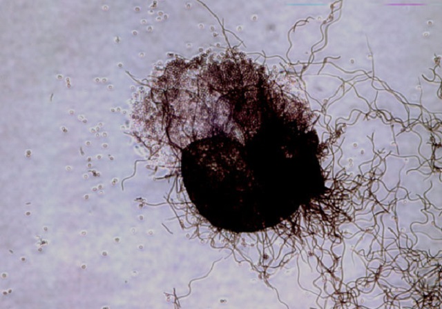 Nấm đối kháng Chaetomium