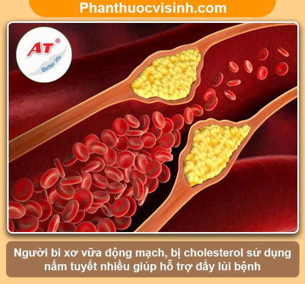 Nấm tuyết có tác dụng gì? Công dụng & Lợi ích với sức khỏe