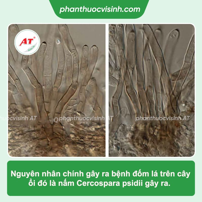 Bệnh đốm lá trên cây ổi: Dấu hiệu và cách phòng trừ triệt để