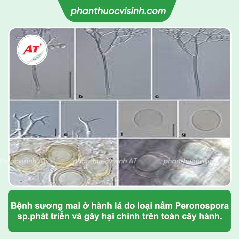 Nguyên nhân gây bệnh sương mai hành lá và cách phòng trị bệnh