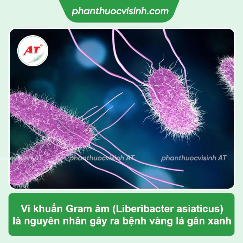 Cách phòng trị bệnh vàng lá gân xanh trên cây cam hiệu quả