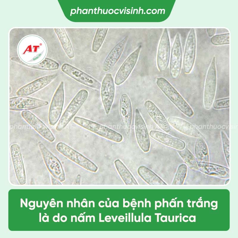 Cách phòng trị bệnh phấn trắng trên cây ớt và Nguyên nhân 2 Nguyên nhân bệnh phấn trắng trên cây ớt và cách khắc phục