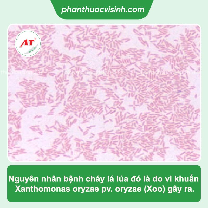 Bệnh cháy bìa lá lúa: Nguyên nhân do đâu và Cách phòng trị 2 Khi ruộng bị bệnh cháy lá lúa thì nên làm gì? Cách phòng trừ