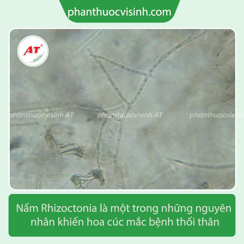 Bệnh thối thân hoa cúc: Nguyên nhân và cách phòng trị